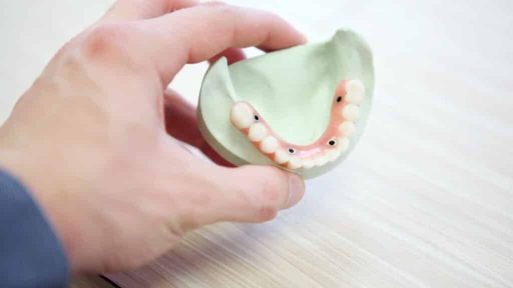 Free Dental Grants for Recovering Addicts
