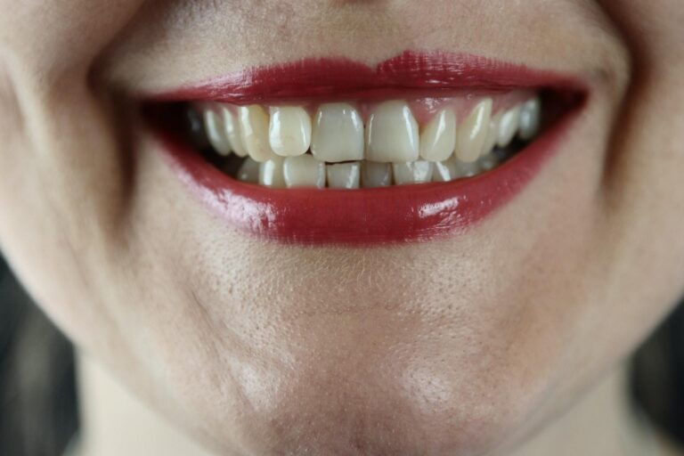 Dental Grants for Recovering Addicts