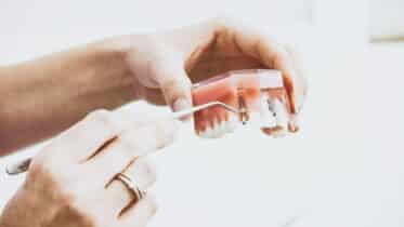 Free Dental Implants Clinical Trials 2023 How to Apply? Free Dental Implants Clinical Trials 2023 How to Apply?
