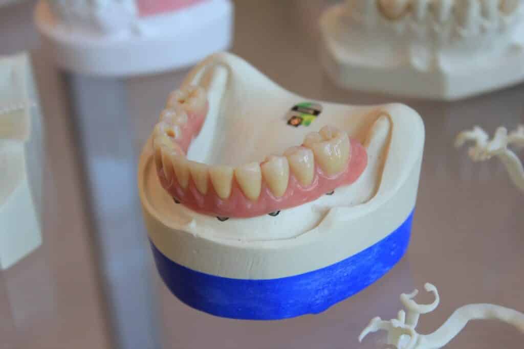 Dental Grants for Single Mothers - Medicaid for Dental Care