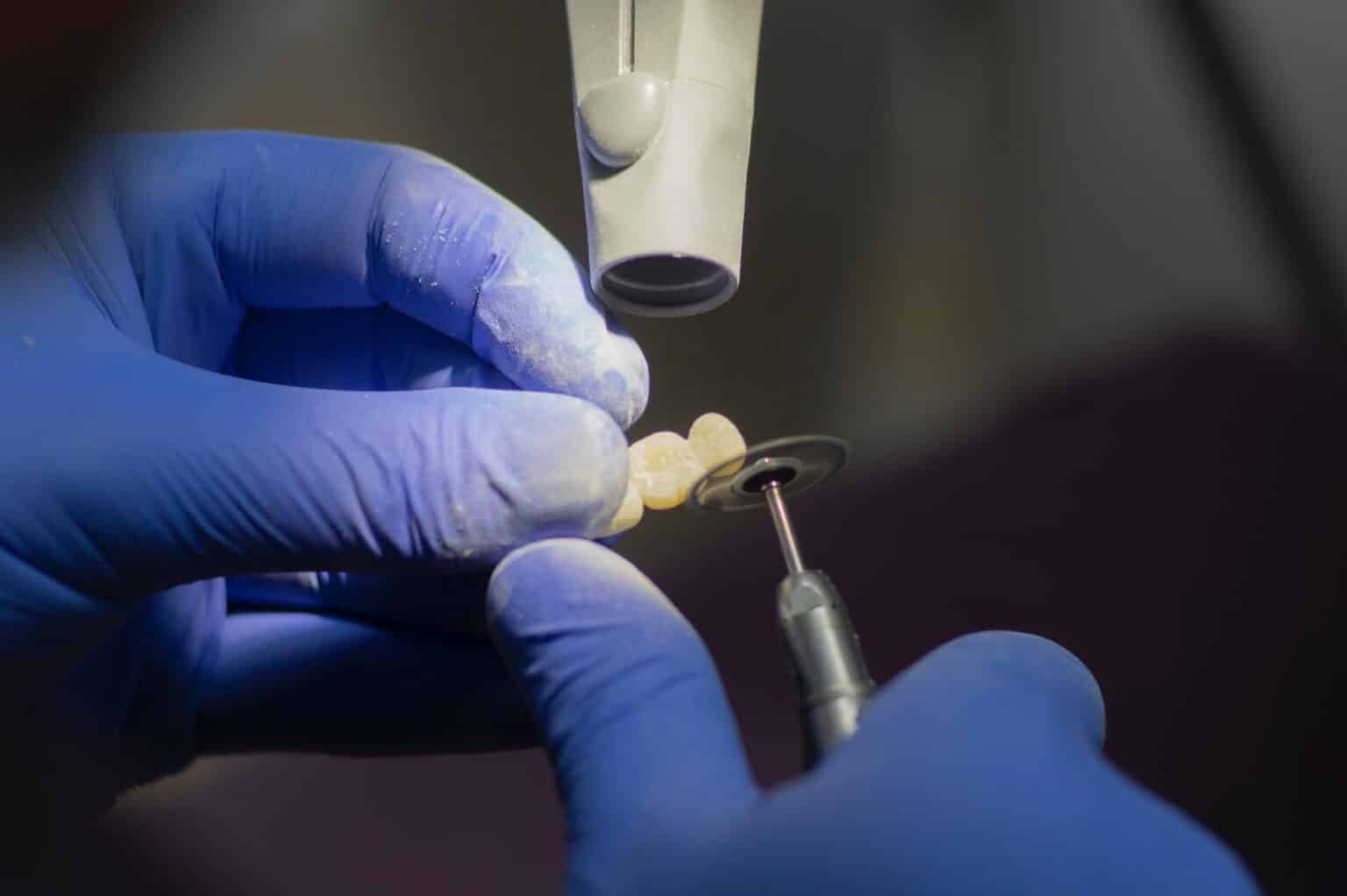 Free Dental Implants for Recovering Addicts Grants for Medical