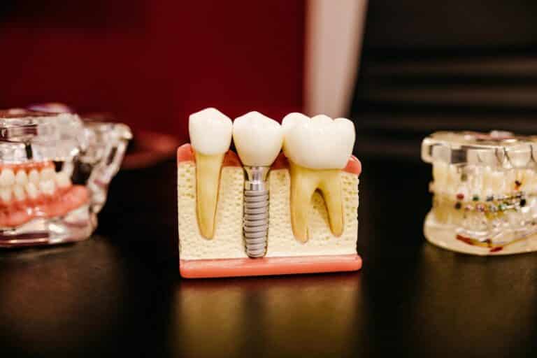 Dental Grants for Senior Citizens