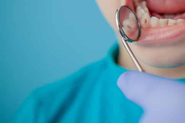 Dental Charities for Adults - To Regain your Smile