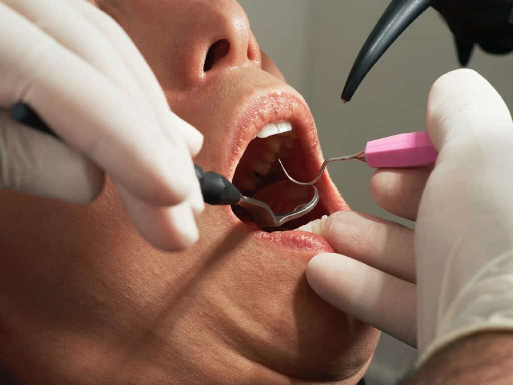 Dental Grants in Arkansas - are you eligible for the grants?