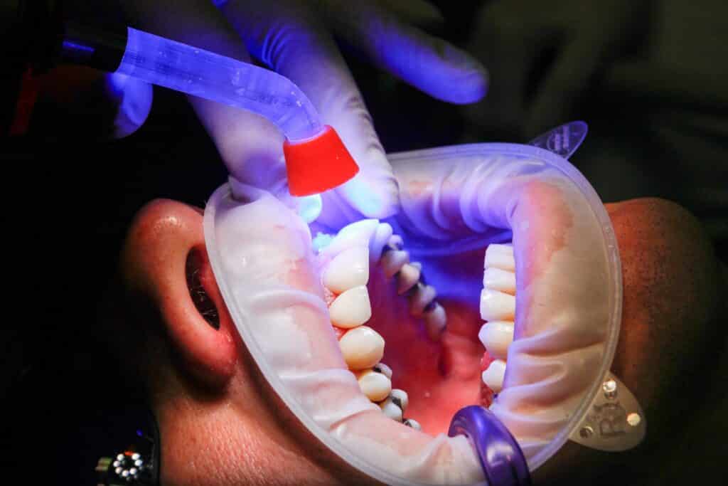 Dental Grants in Florida - Dental Grants