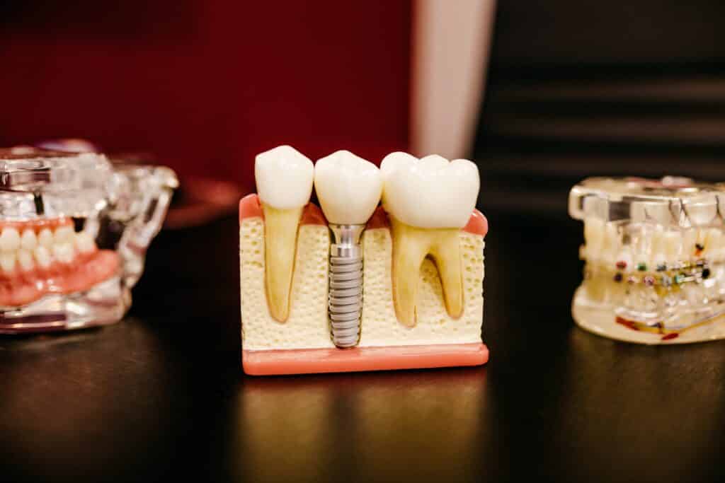 Dental Grants in Arizona - Dental Grants
