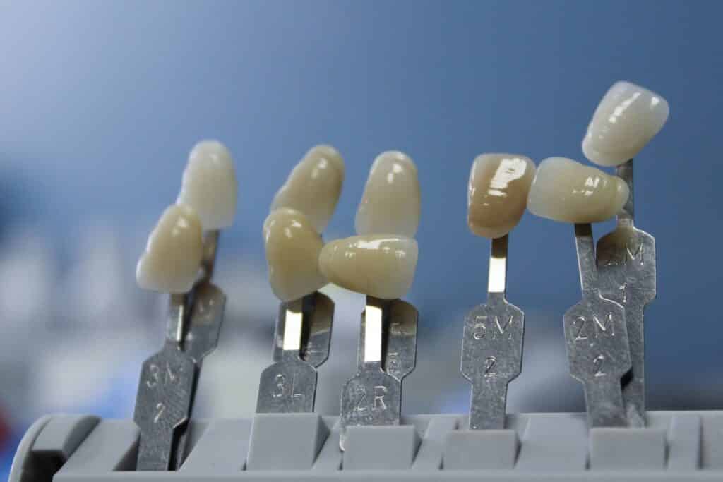 Dental Grants in Illinois - How to apply for the grants?