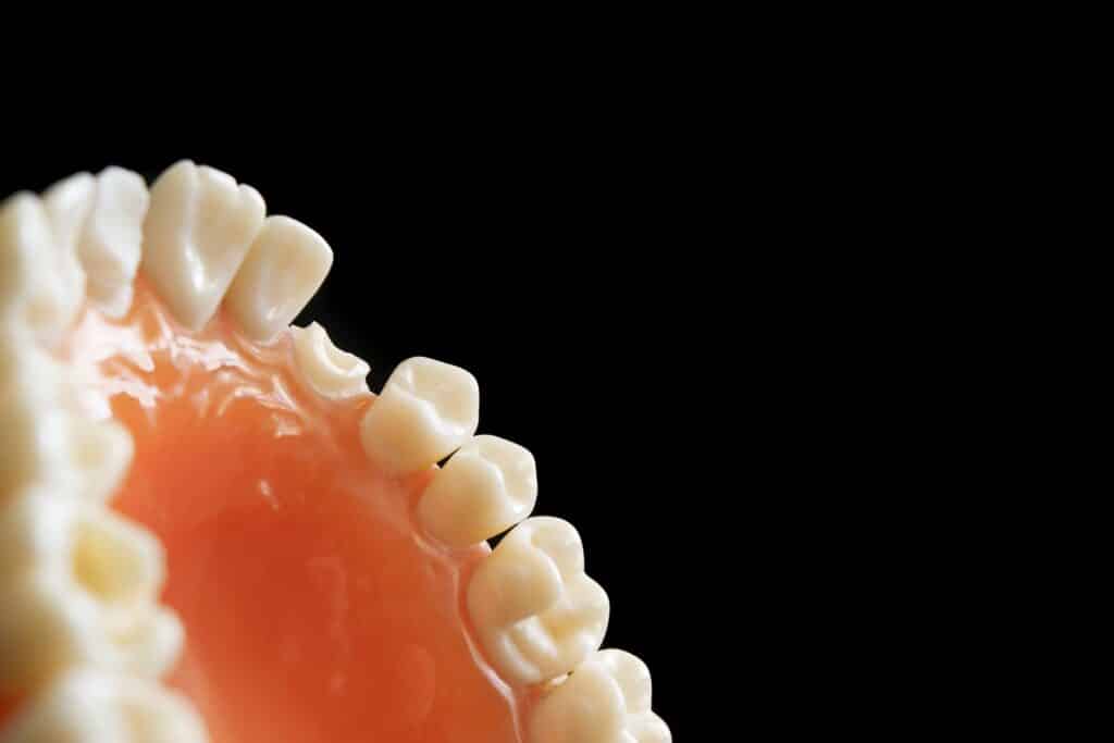 Dental Grants in Missouri - Dental grants for the low-income and underserved