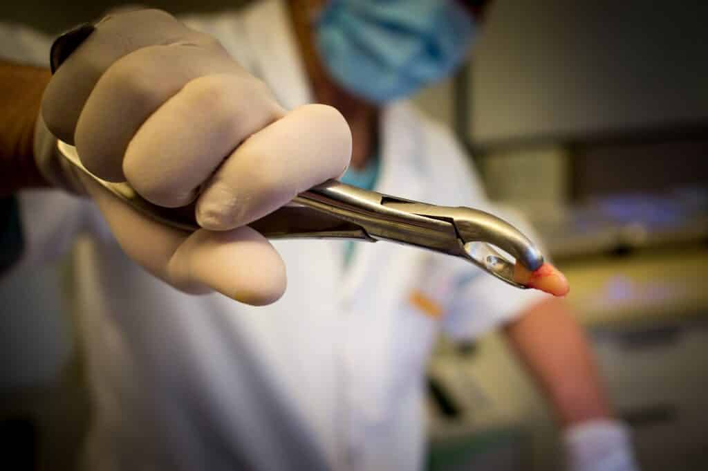 Dental Grants in Maryland - How to apply?