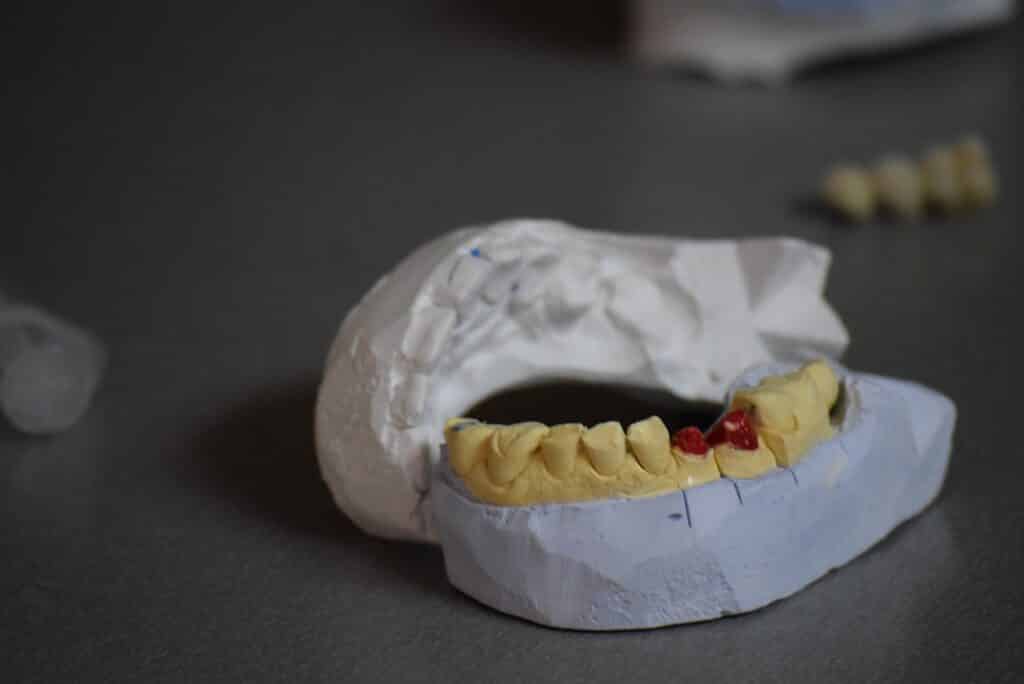 Dental Grants in Utah - Oral Care Services for those in Need