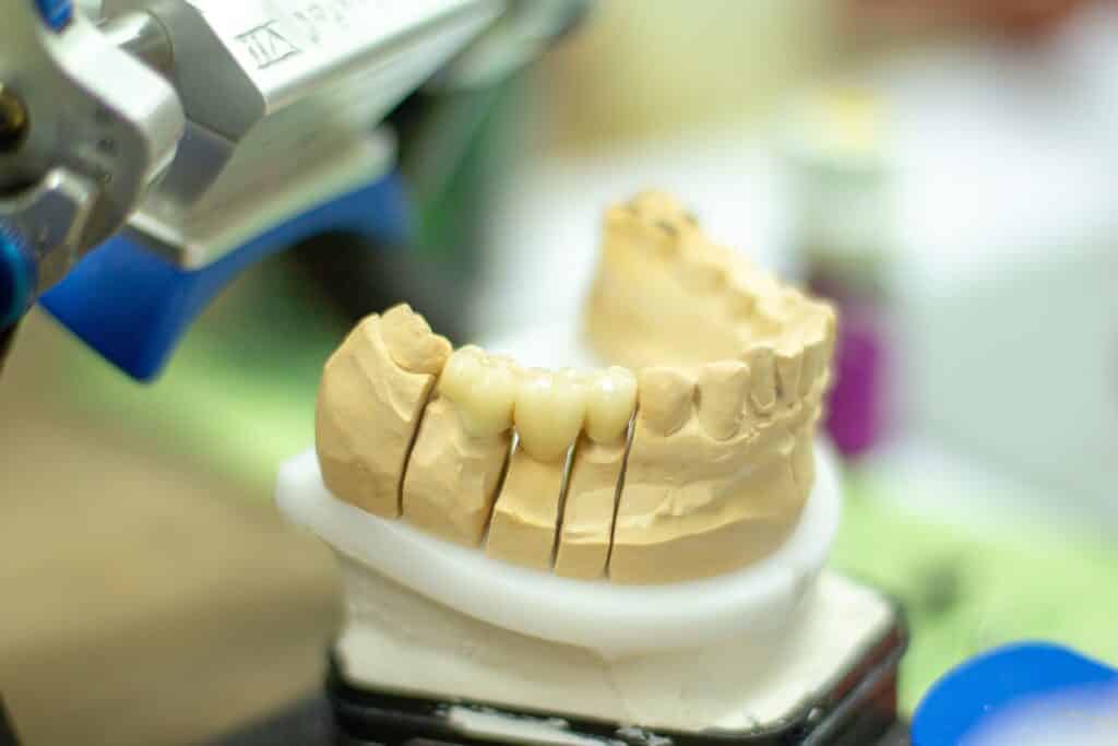 Dental Grants in Michigan - How to apply for the dental grants?