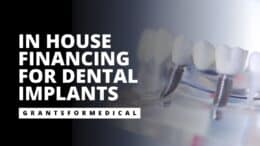 In House Financing for Dental Implants