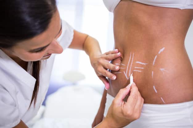 Grants for Mommy Makeover