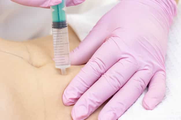 Medical Loans for Bariatric Surgery - Affordable & Easier Options Available