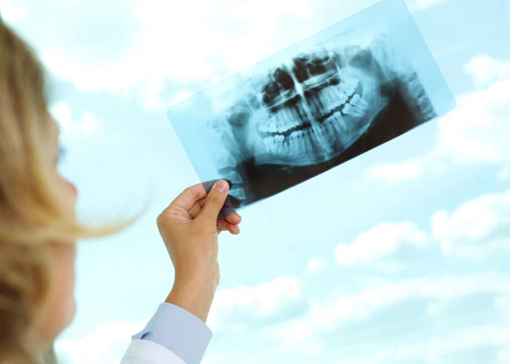 Does Medicare Cover Dental Implants