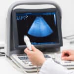 Sonography Programs California