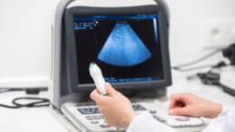 Sonography Programs California