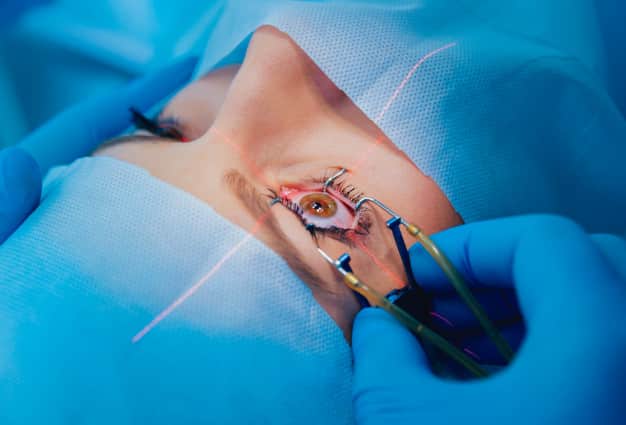 Laser Eye Surgery Cost