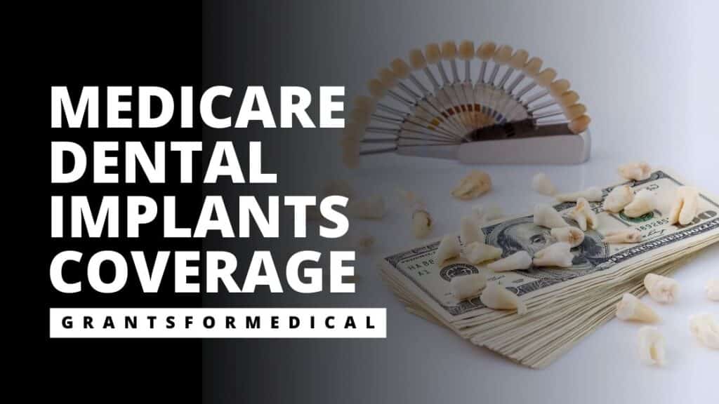 Does Medicare Cover Dental Implants? Grants for Medical