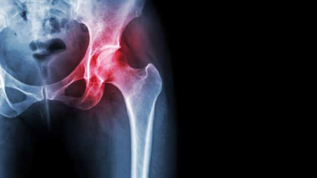Rheumatology Research Foundation Grants - Access to Specially Trained Rheumatology Professionals