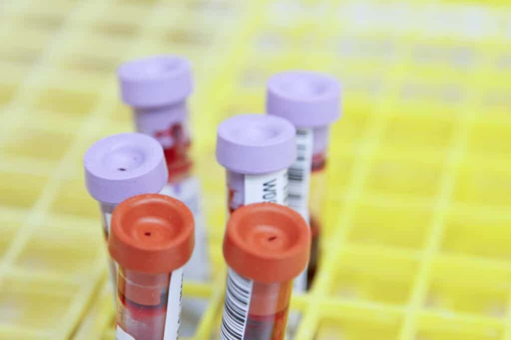 Phase 1 Clinical Trial - To Find the Most Competent Dose