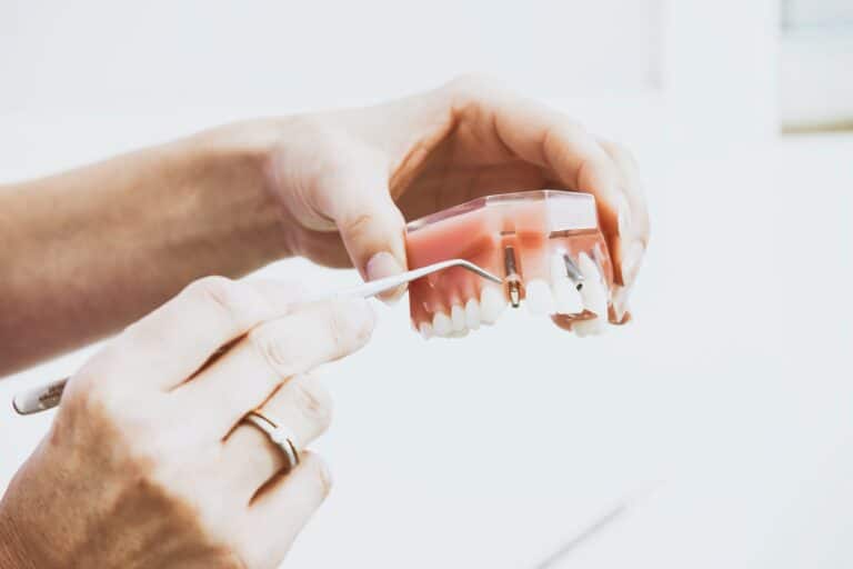 Types of Dental Implants Cost