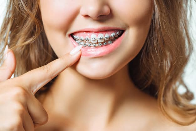 Grants for Braces - Where to Apply?