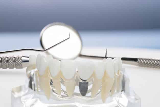 Grants for Dental School - Attending Dental School