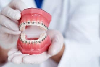 Grants for Braces - Improving Smiles