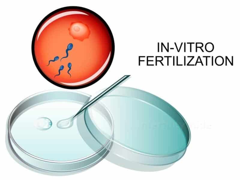Fertility Treatments Cost