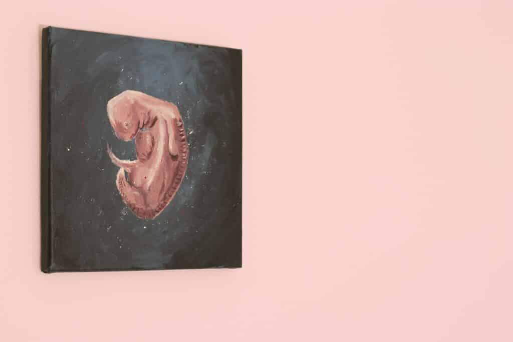 Grants for Abortion - Medication Abortion