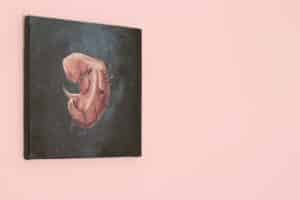 Grants for Abortion Grants for Abortion - Medication Abortion