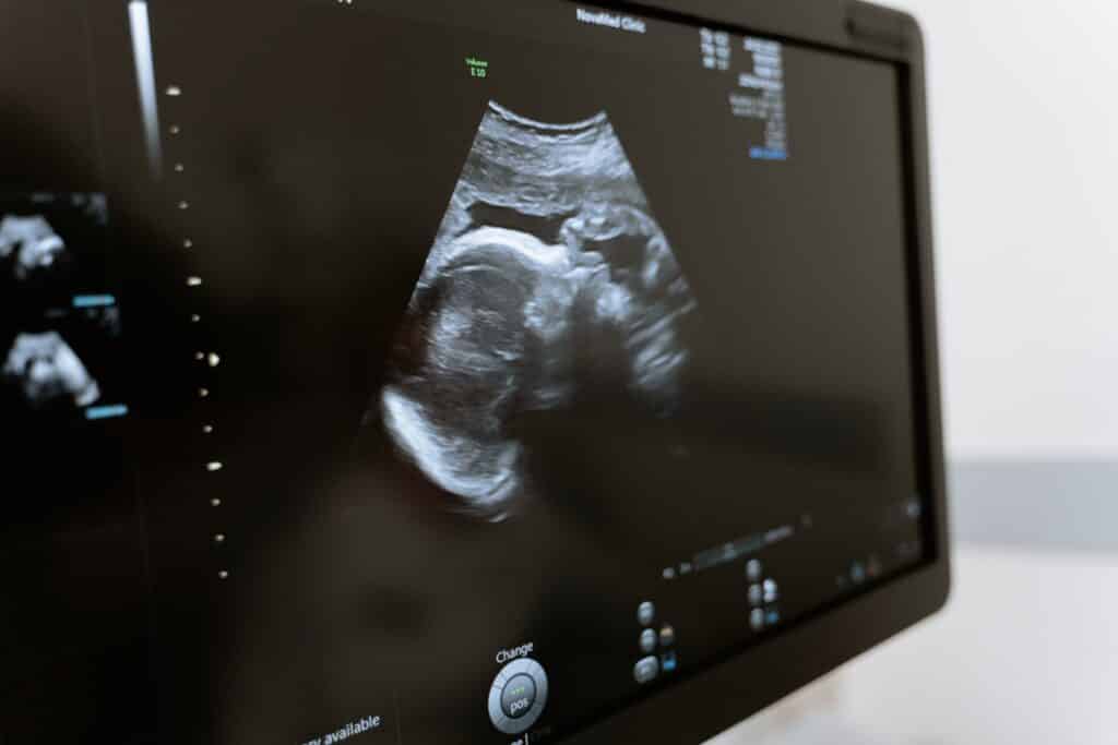 IVF Grants in Oregon - Steps