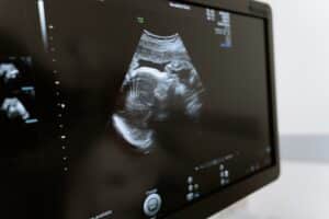 IVF Grants in Oregon IVF Grants in Oregon - Steps