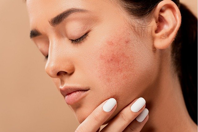 Best Dermatology Schools