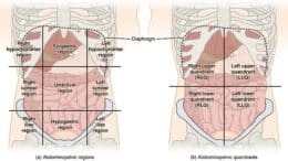 What is apronectomy