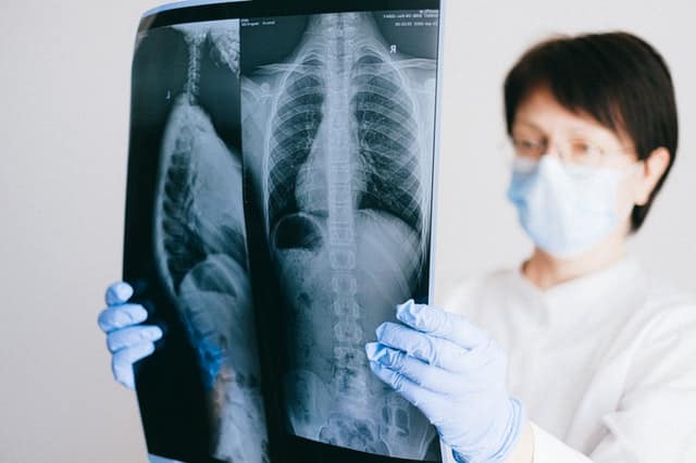 Clinical Trials for Pulmonary Fibrosis Treatment
