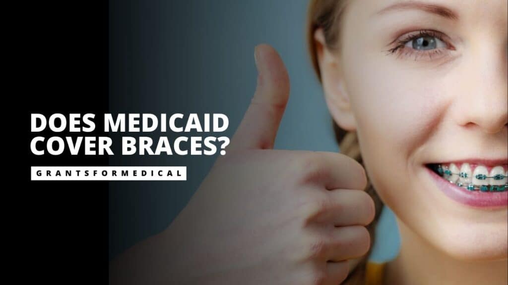 Does Medicaid Cover Braces? How to Qualify?
