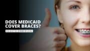 Does Medicaid Cover Braces