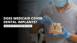 Does Medicaid Cover Dental Implants