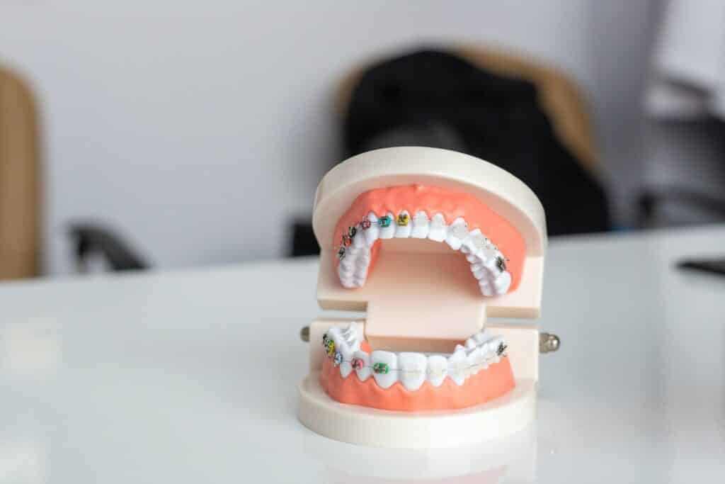 What are the treatments present to replace damaged or lost teeth