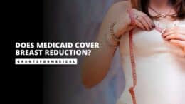 Does Medicaid Cover Breast Reduction