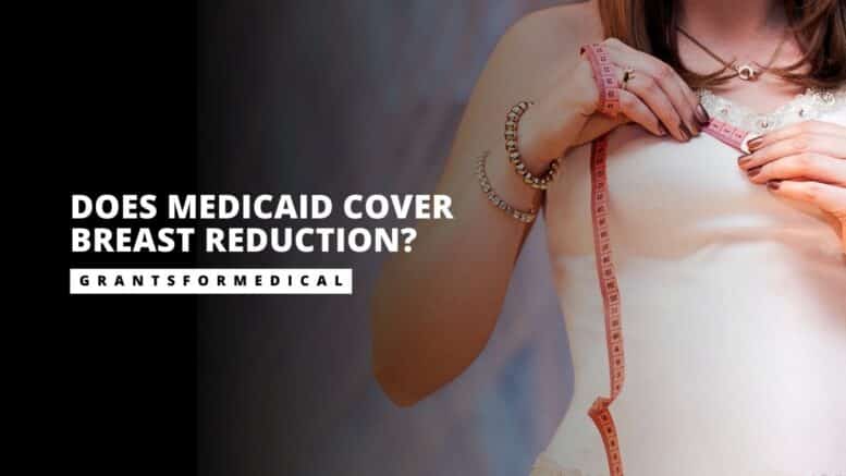 Does Medicaid Cover Breast Reduction