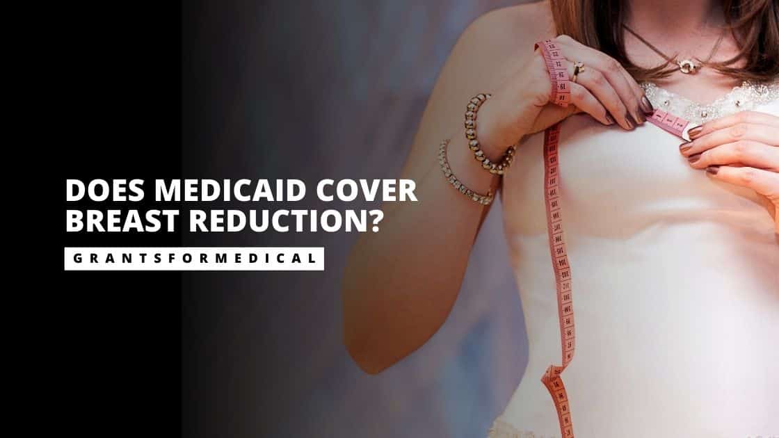 Does Medicaid Cover Breast Reduction