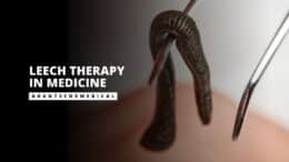 Leech Therapy in Medicine