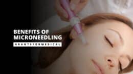 What is Microneedling