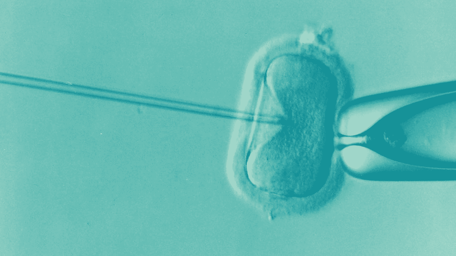 What Does the Donor Egg IVF Cost in the US? Grants for Medical
