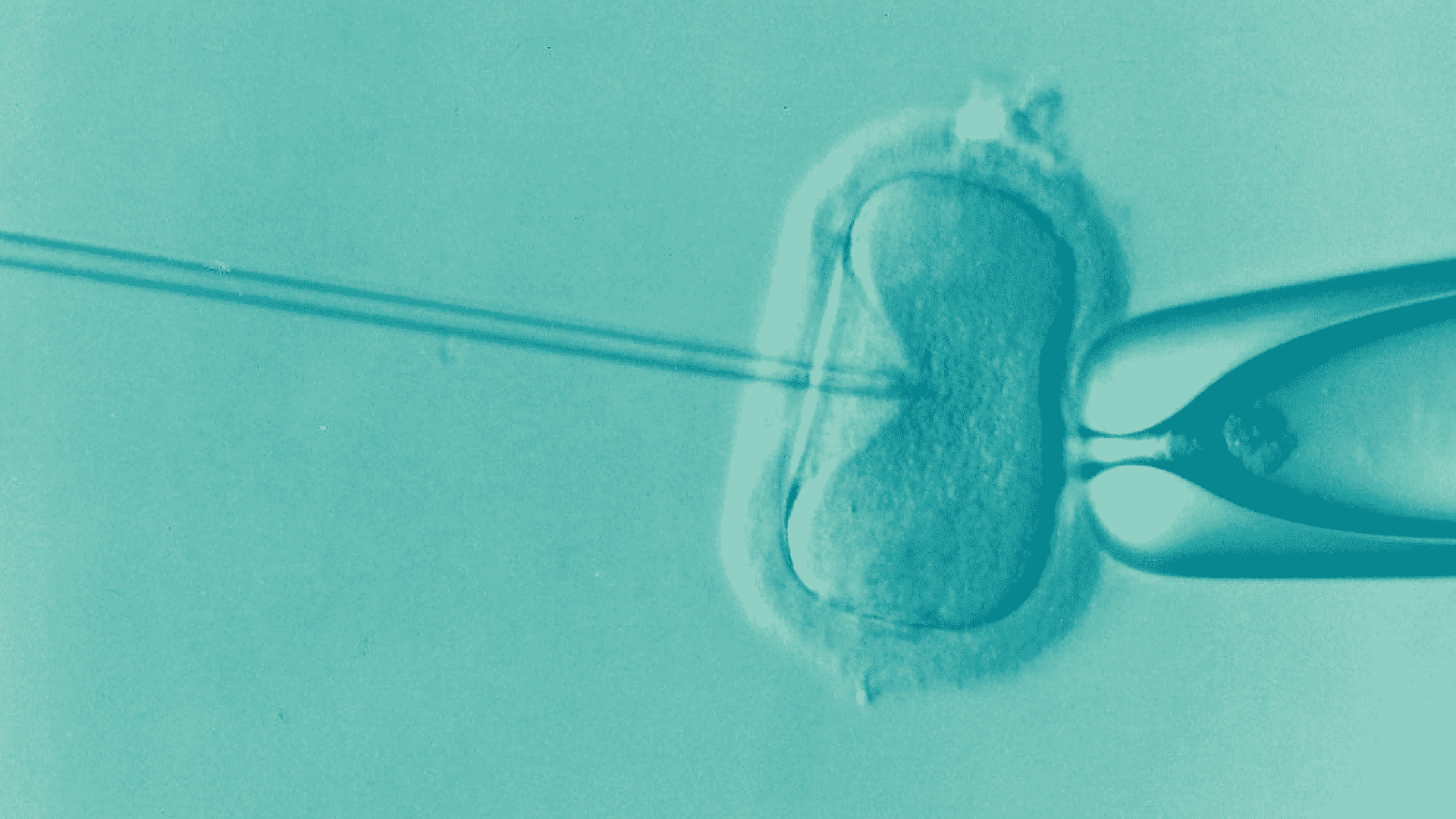donor egg ivf cost