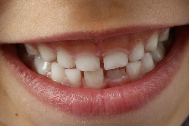 Does Medicaid Cover Wisdom Teeth Removal