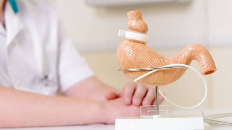 Lap Band Surgery Cost Without Insurance